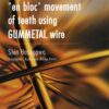 A Concept Of 'En Bloc' Movement Of Teeth Using Gummetal Wire