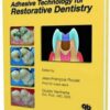 Adhesive Technology For Restorative Dent