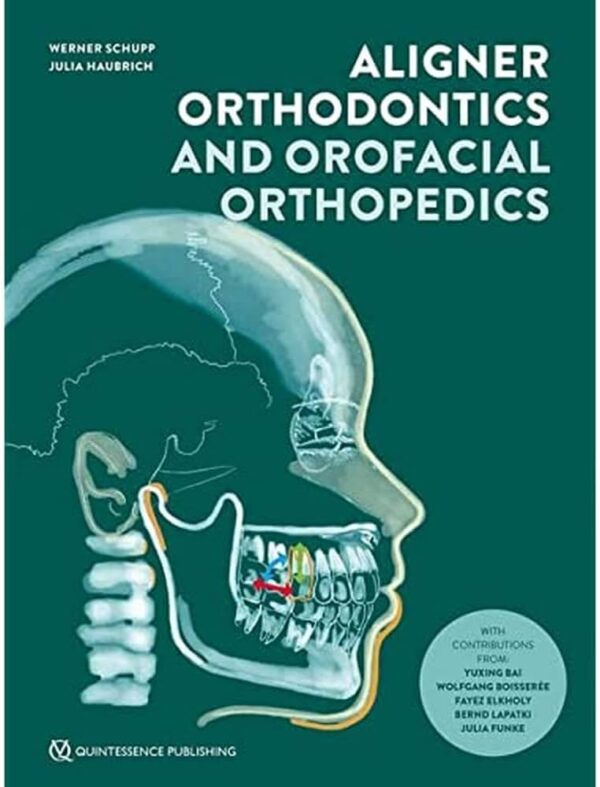 Aligner Orthodontics: Diagnostics, Biomechanics