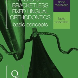 Atlas Of Bracketless Fixed Lingual Orthodontics: Basic Concepts