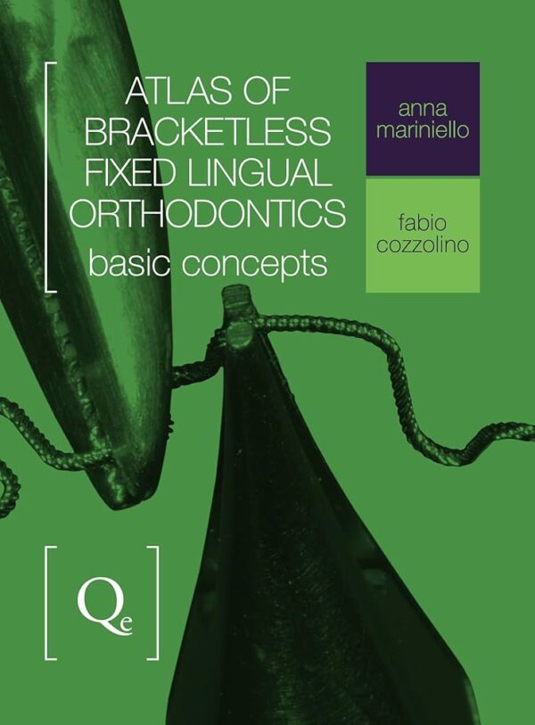 Atlas Of Bracketless Fixed Lingual Orthodontics: Basic Concepts