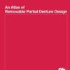 Atlas Of Removable Partial Denture Des