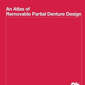 Atlas Of Removable Partial Denture Des