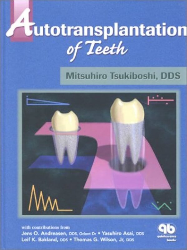 Autotransplantation Of Teeth