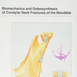 Biomechanics:Osteosynthesis Condylar