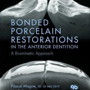 Bonded Porcelain Restorations Anterior Reg