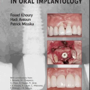 Bone Augmentation In Oral Implantology