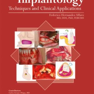 Bone Grafting In Oral Implantology