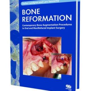 Bone Reformation