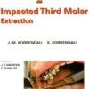 Clinical Success In Impacted Third Molar Extract