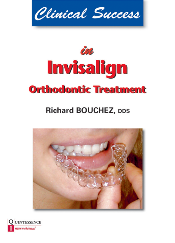 Clinical Success In Invisalign Orthodontic Treatment