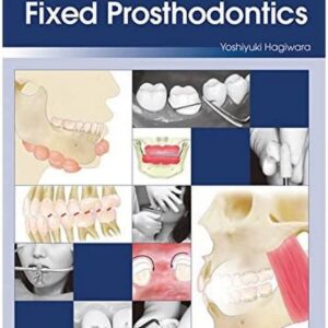 Color Atlas Of Fixed Prosthodontics