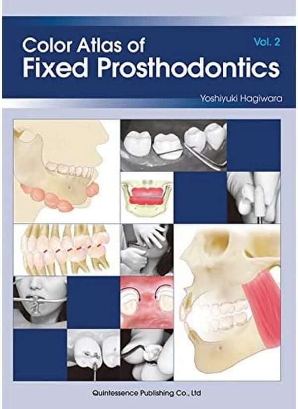 Color Atlas Of Fixed Prosthodontics