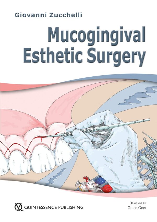 Mucogingival Esthetic Surgery