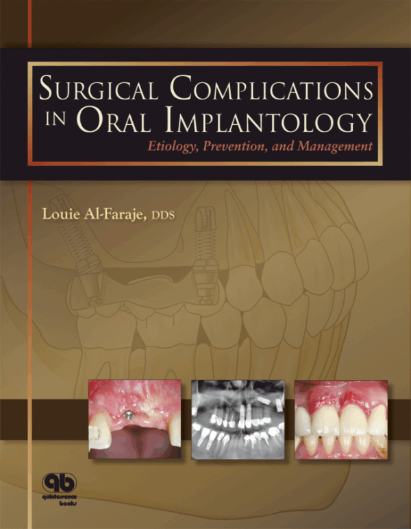 Surgical Complications In Oral Implantology: Etiology, Prevention And Management