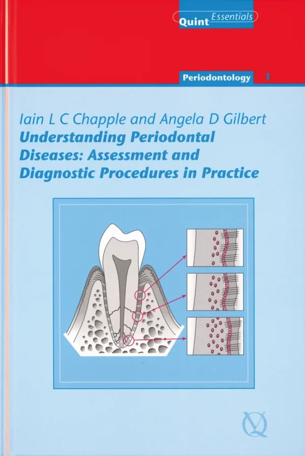 Understanding Periodontal Diseases: Assessment and Diagnostic Procedures in Practice